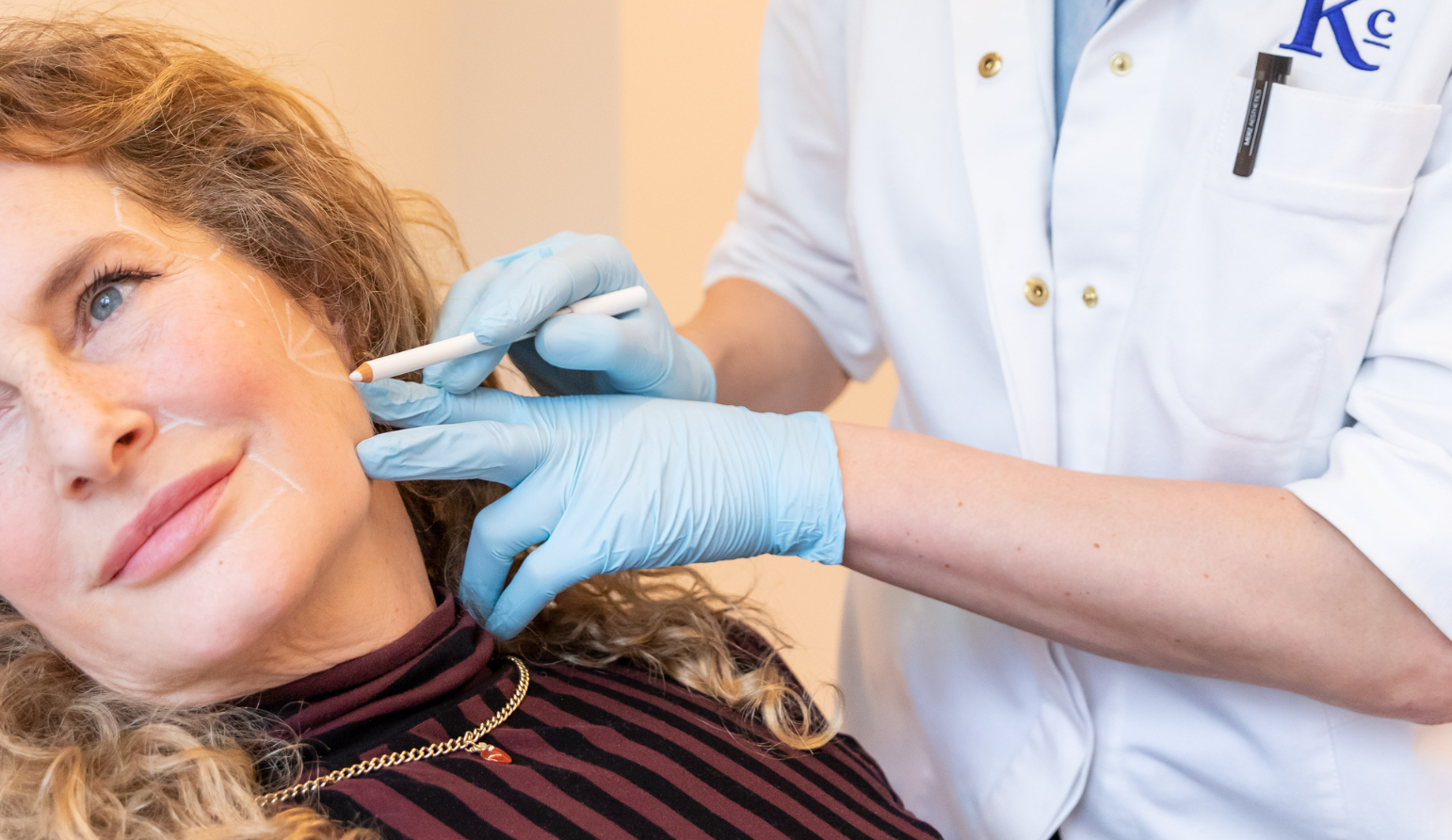 Radiesse Filler behandelingen